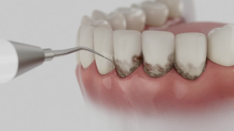 Trusted Wisdom Tooth Removal service in Horseshoe Bend, AR - Dentist Open Now